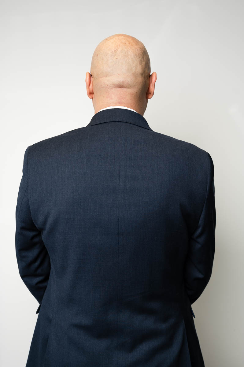 Portrait of refugee Ahmad with his back towards the camera showing his bald head