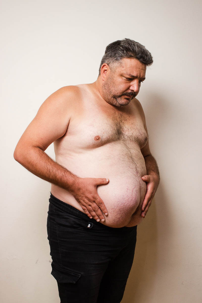Portrait of refugee Emad shirtless standing sideways with both his hands holding his belly